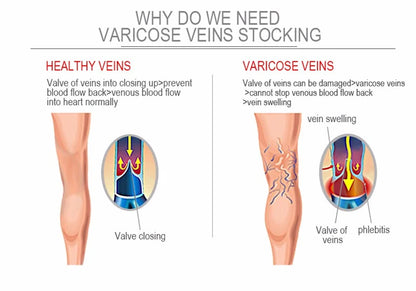Compression Socks Varicose Veins Men's And Women's Sports Socks Football 20-30 Mmhg Elastic Anti Fatigue Pain Relief Wholesale